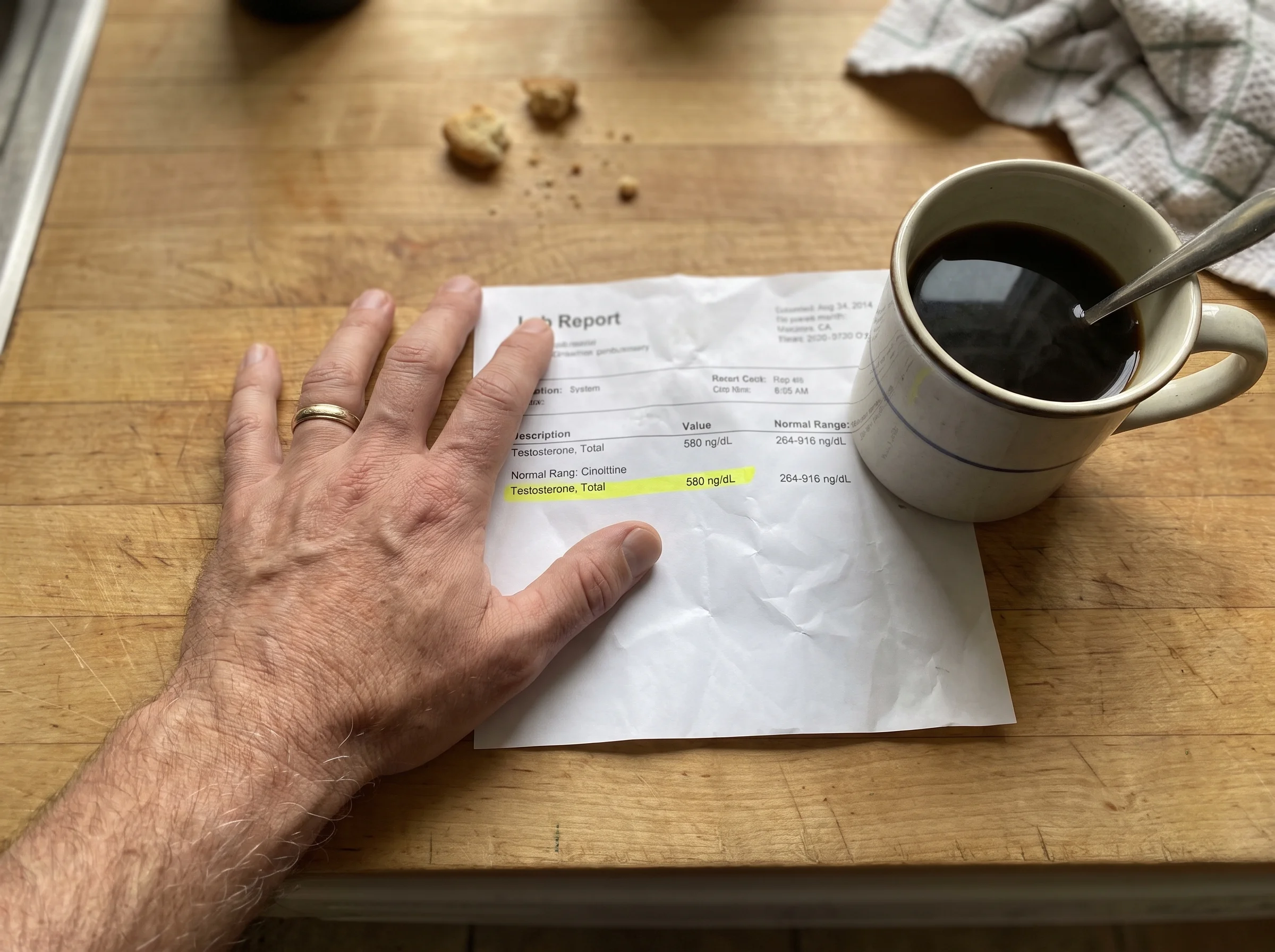 Close-up of a lab report printout on a kitchen counter next to a cold cup of coffee, testosterone value highlighted in yellow
